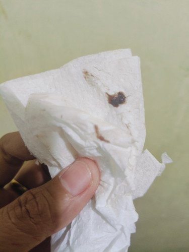 Hello po.
Ask ko lang po kung anong meron bakit ako nagkaroong ganito.2 months pregnant