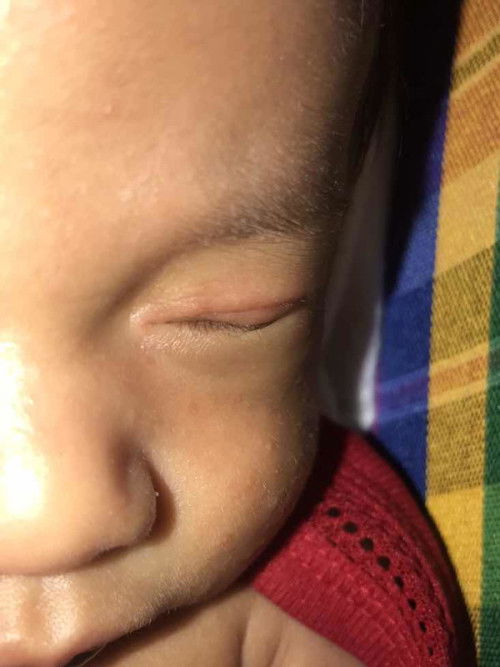 ตายน้องเป็นไรไม่รู้ค่ะแม่ๆ