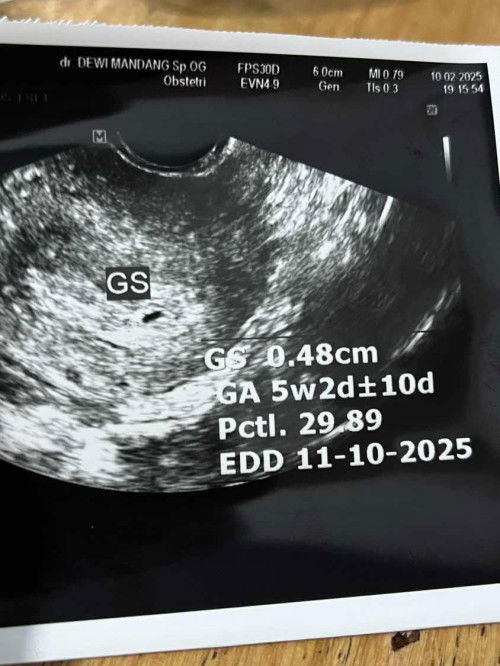 Gs 0.48cm usia 5minggu