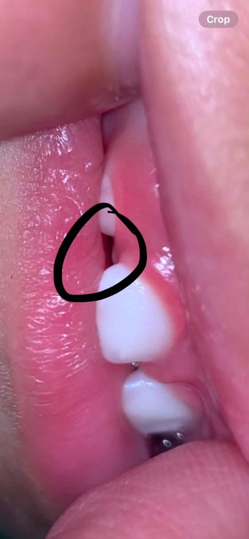 Gigi anak 1 tahun 4 bulan