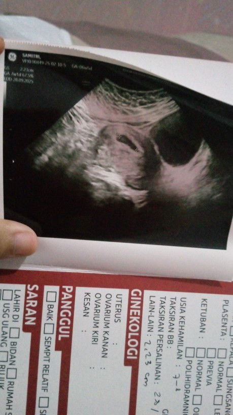 Keluar darah segar dan flek selama 1 minggu