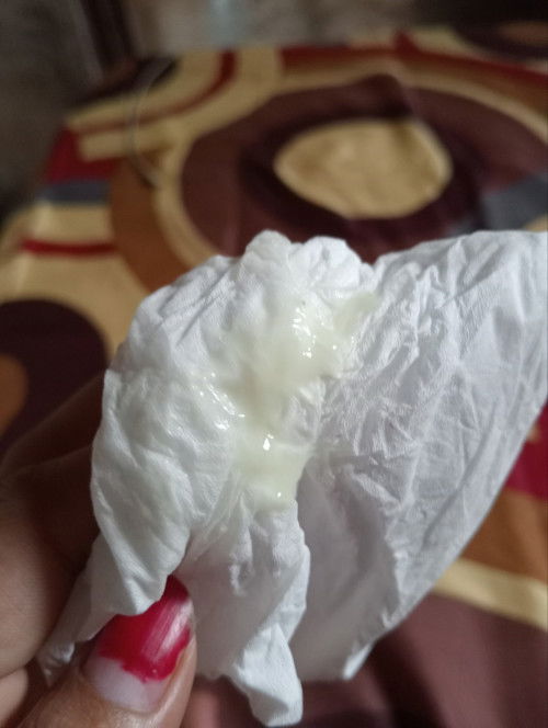 Lewat hpl.. masih begini warna keputihan ny,,