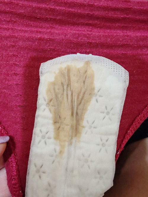 Brown discharge at 33weeks