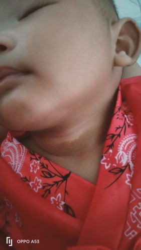 ที่คอน้องเป็นสีคล้ำๆ