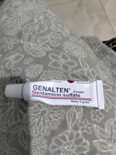 Rekomendasi gak ya salap genalten dari bidan