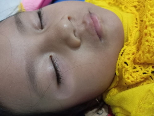 mau tanya ya mom ini di bagian area bawah mata kok putih2 gitu ya sudah 3 bulan