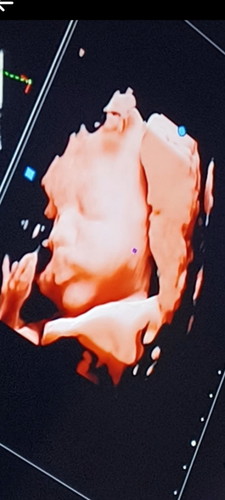 ท้อง29+6 ลูกนน.1700กรัม เเม่ๆบ้านอื่นเท่าไรกันเเล้วคะ 🥰