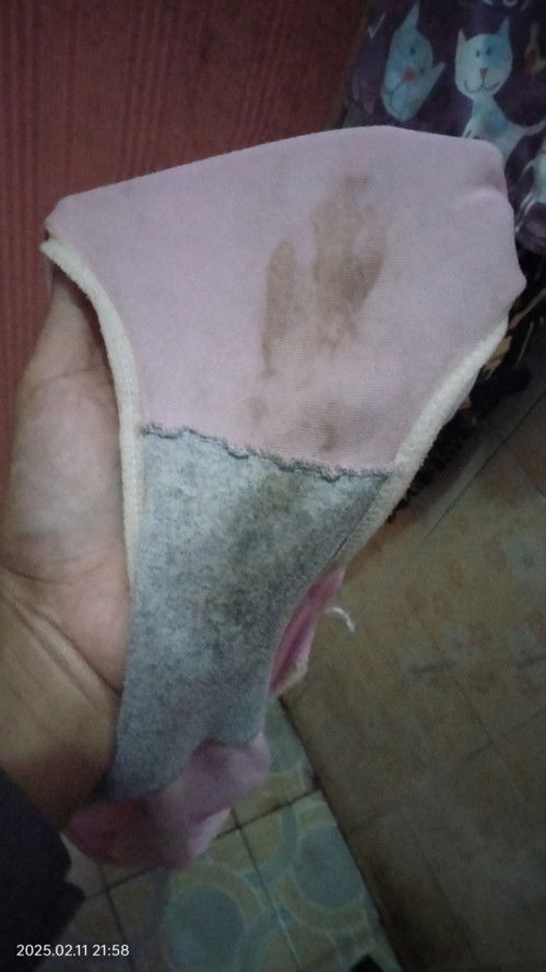 Flek di usia 27minggu