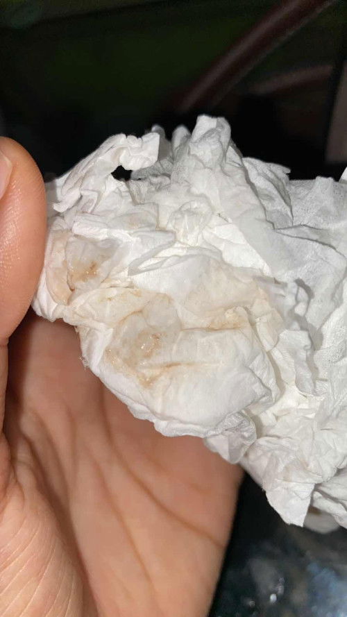 Warna coklat , flek atau keputihan?