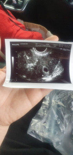 ยุติการตั้งครรภ์แล้ว