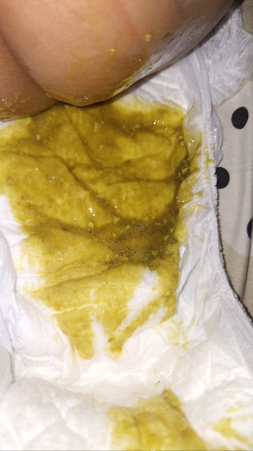 Pup bayi 6 bulan seperti ada biji cabai