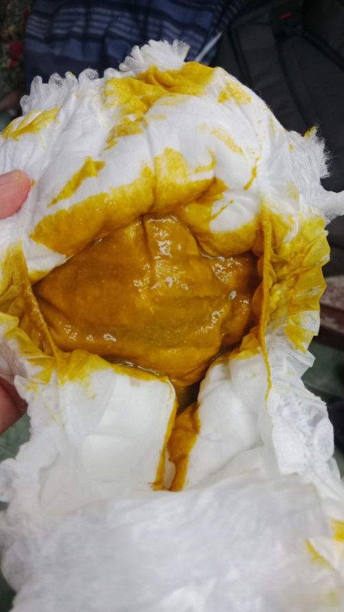 Maaf kalo sedikit jorok bun ini baby saya umur 3 bulan kenapa bab nya ber lendir ya