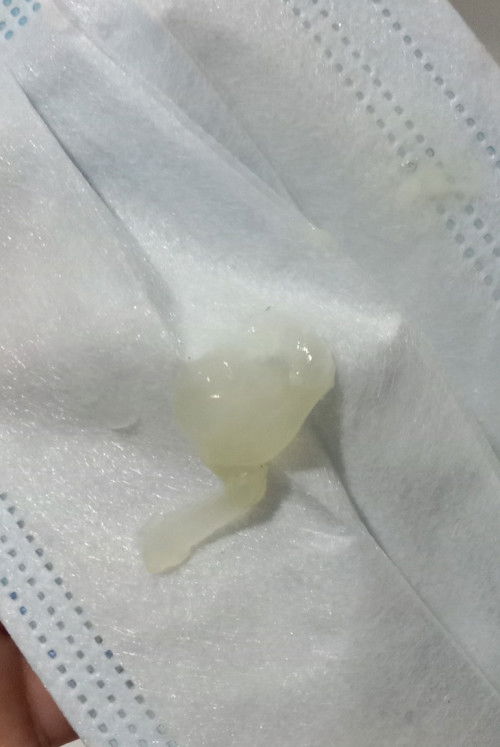 มีแม่ๆคนไหนเป้นเหมือนกันบ้างค่ะ