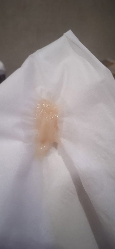 Keluar lendir seperti jelly