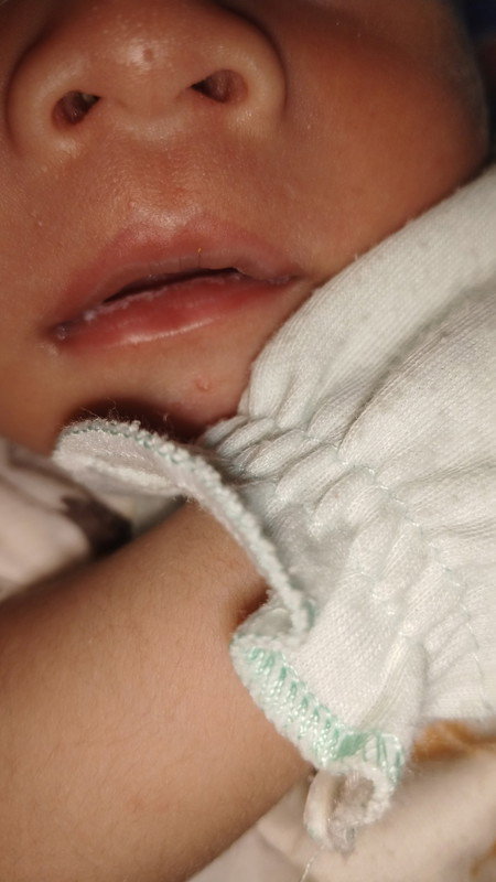 Membersihkan putih" Dimulut baby bekas asi/jamur
