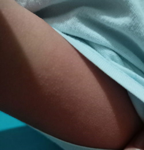 Skin Allergy po kya ito