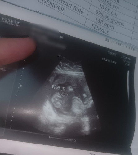 Sure na po ba na baby Girl to??😊❤️