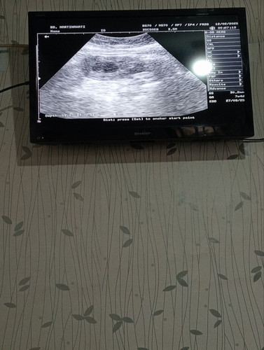 Bantu jawab bunda bunda