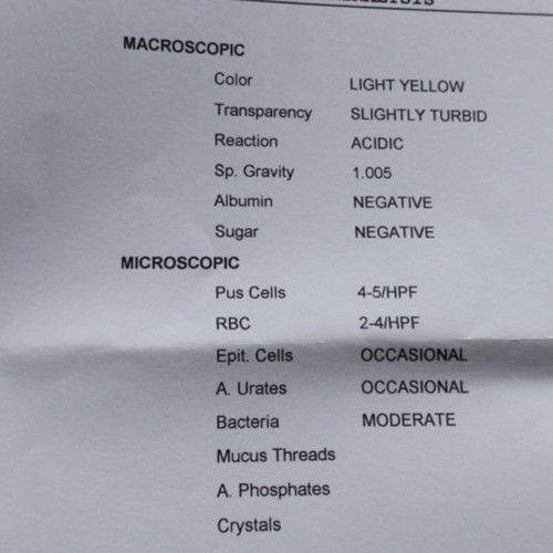 About UTI question po
