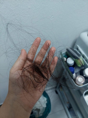 Rambut gugur