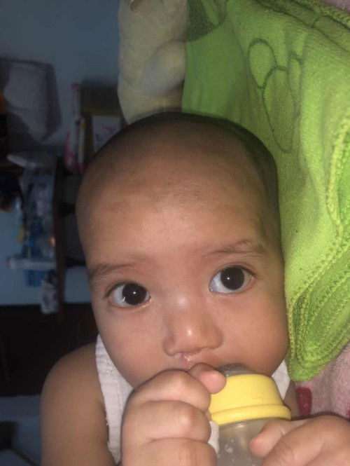 ผื่นนนค่ะพึ่งขึ้นน้อง5เดือน20วัน