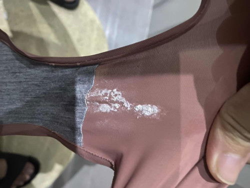 White Discharge at 36 weeks