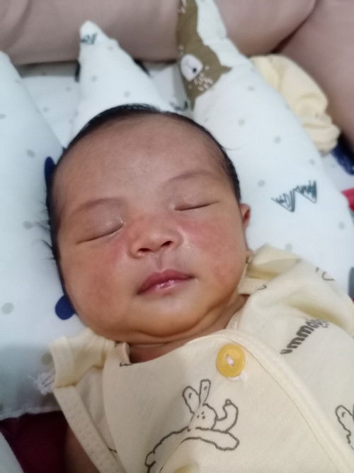 Ruam merahhh diwajah