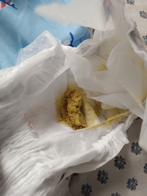 Normal Pupu ng 1 week old