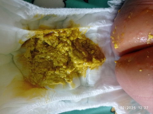 Fases anak umur 3 bulan ..