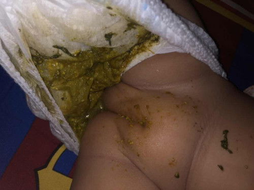 Pup Bayi Ada wrna hitam kehijauan