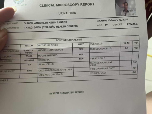 May uti po ba?