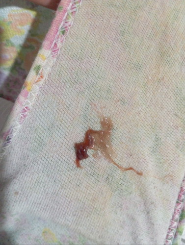 Mucus plug na po ba ito?