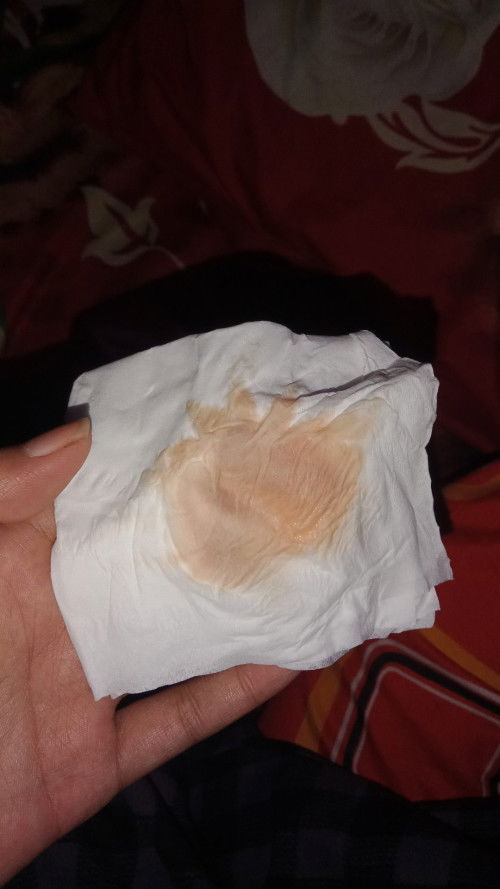 Cairan keluar dari vagina