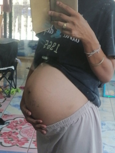 36w5d น้ำหนัก2, 700