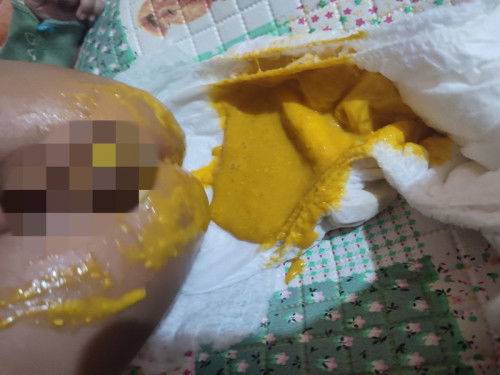 Apakah pup kaya gini diare?