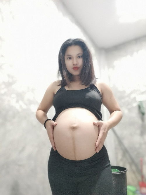 คลอดเอง+ทำหมัน vsผ่าคลอด+ทำหมัน