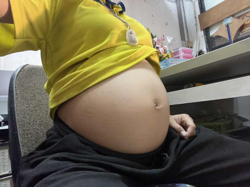 อายุครรภ์20week