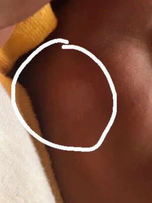 แบบนี้กลากน้ำนมรึป่าวคะ