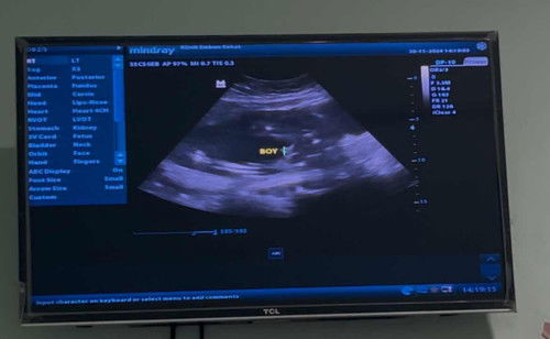 Diusia berapa si dedek nunjukin jenis kelaminnya?