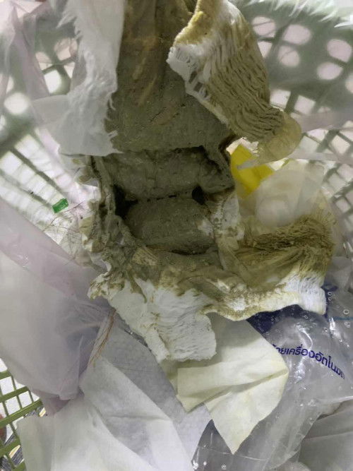 อึลูกแบบบนี้ปกติไหมคะ6เดือน23วันกินนมผงค่ะ