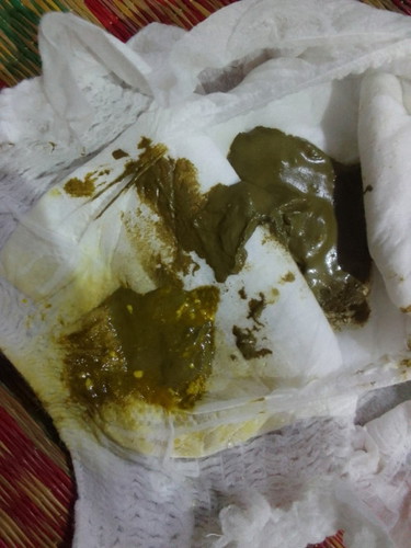 แบบนี้ปกติมั้ยคะ