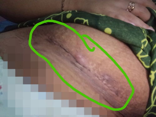 Tolong di jawab bun saya takut