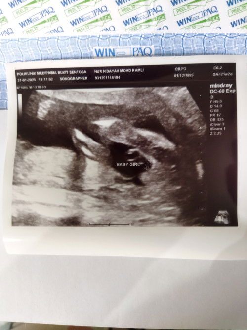 Hai, nk tnya kalo mcm nie agak2 confirm baby girl ke? Tringin nk baby girl...