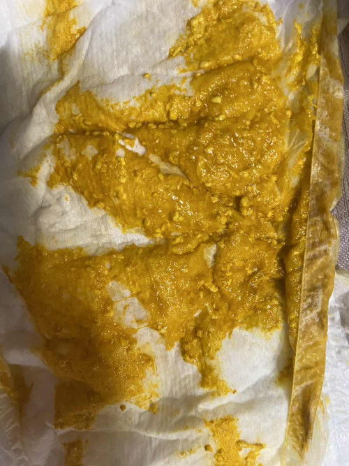 ลูกถ่ายปนมูก นมแม่ล้วน