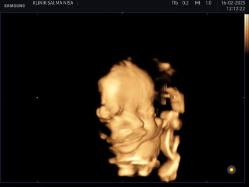 Bun ini jelas bagus  apa engga si takut bgtt