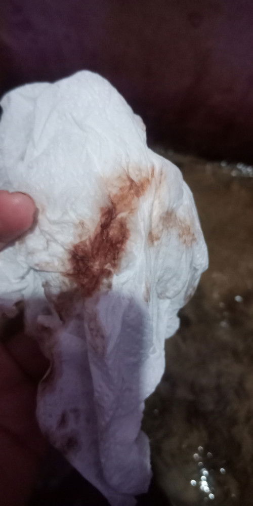 Assalamualaikum bunda2.
Bund ada yg hpl maret tgl 23an ini msuk 35wek,td bngun tdr kluar bercak cklt