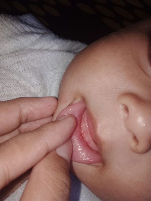 Anak gtm, karna faktor apa yaa??