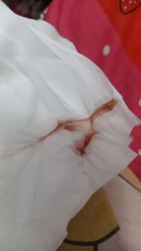 Keluar lendir darah tp blm mules hpl 17februari