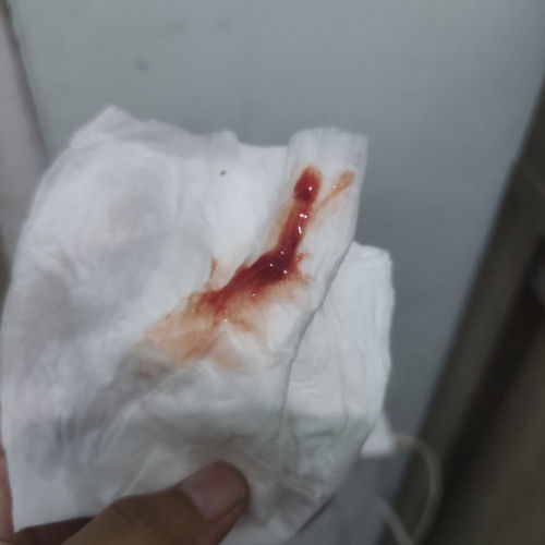 Lahir 14 feb 2025 hpl 20 feb trus brubah jd 17 feb