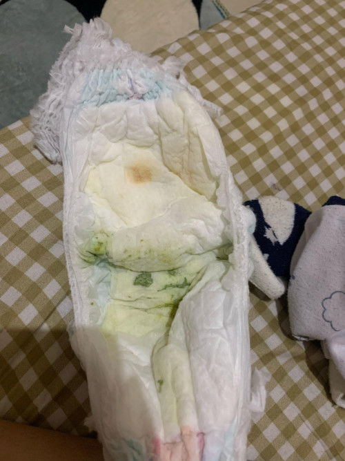 mau tanya ini kenapa ya bun yg coklat coklat ini, adek lagi diare sudah 3 hari